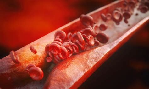 Pre-procedure cardiogenic shock and older age tied to mortality in left ...