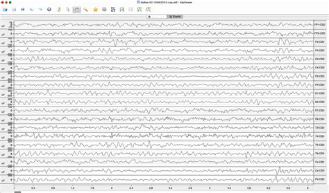 Image result for MATLAB Qeeg Brain Map