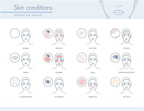 Hormones and Skin conditions: The complete guide