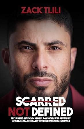 Scarred Not Defined: Reclaiming Strength and Self – worth after ...