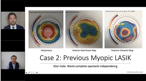 Patients with previous laser correction-are presbyopia-correcting IOLs ...