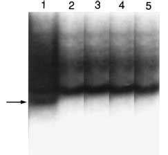 Image result for Conformational Polymorphism