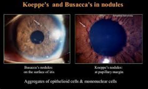 RRMs Next for PG Online Examination Platform