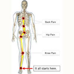 OrthoFitMart - Faulty biomechanics gait and posture