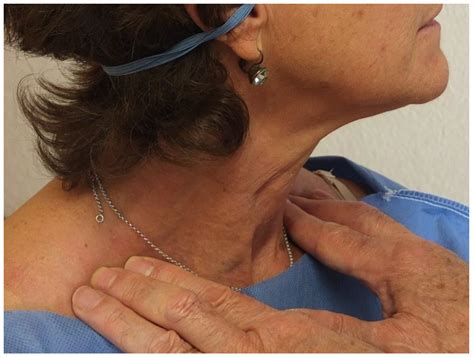 Palpation and Ultrasonography Reveal an Ignored Function of the ...