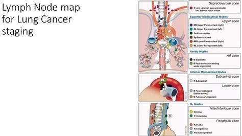 Lung cancer anatomy to pathological classification | PPTX