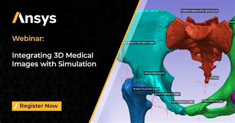 Integrating 3D Medical Images with Simulation | Ansys