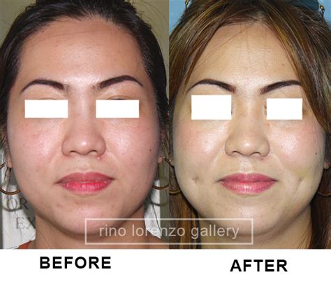 Image result for Simpe Dimple