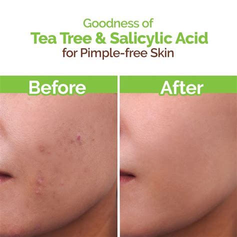 Tea Tree Face Wash for Acne and Pimples -100ml | Mamaearth