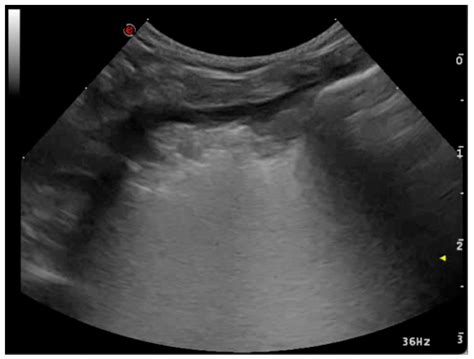 Point-of-Care Lung Ultrasound in Small Animal Emergency and Critical ...