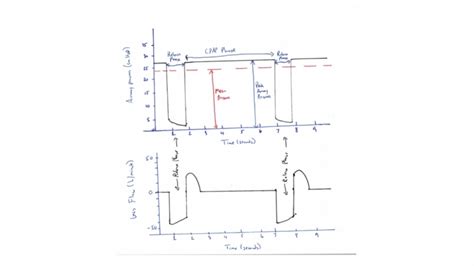 Aprv Pressure Time Graph 的图像结果