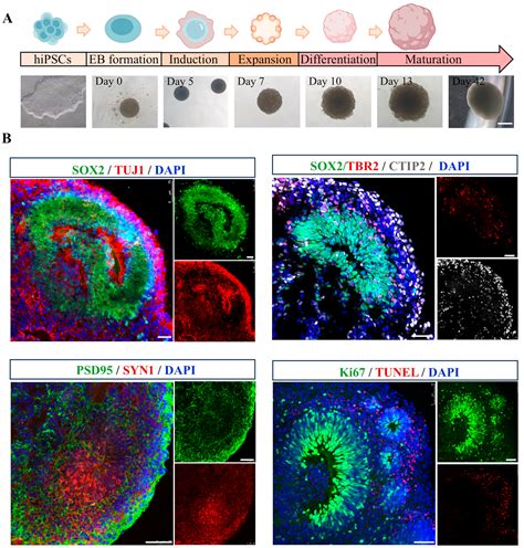 Sea Squirt-Derived Peptide WLP Mitigates OKA-Induced Alzheimer’s ...