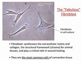 fibroblast 的图像结果