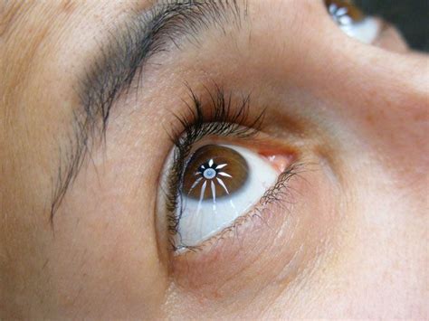 Do you see floating shapes in your eyes? - Rediff.com Get Ahead