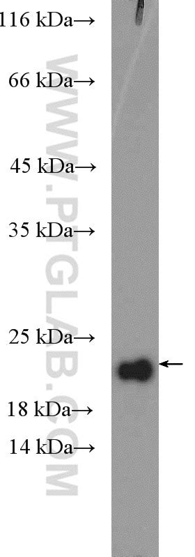 RPP21 antibody (16377-1-AP) | Proteintech