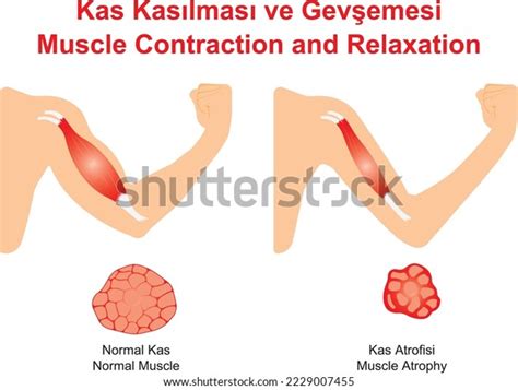 Image result for Mucscl Contraction Animation
