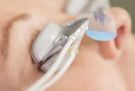 Image result for Computer Vision Oclusion