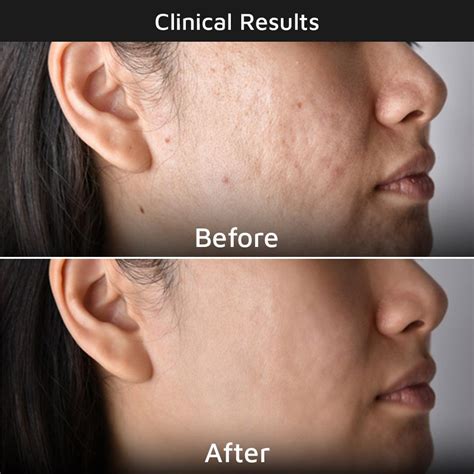 ThriveCo Hydrating Foaming Facial Cleanser | Daily Use Face Wash ...