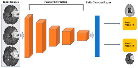 Predicting the Severity of Neurological Impairment Caused by Ischemic ...