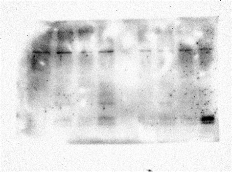 Black spots in Western Blot membrane? | ResearchGate