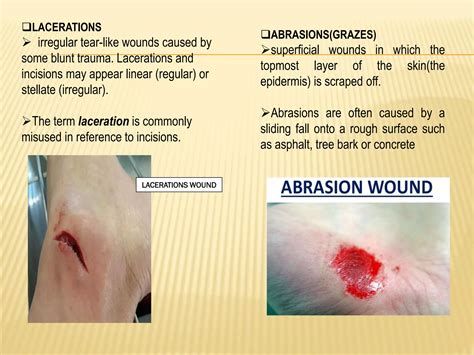 THE ANIMAL BITES AND WOUNDS | PDF