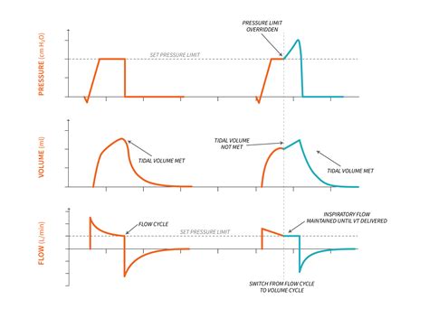 What Is Volume Support Ventilation at Betty Watkins blog