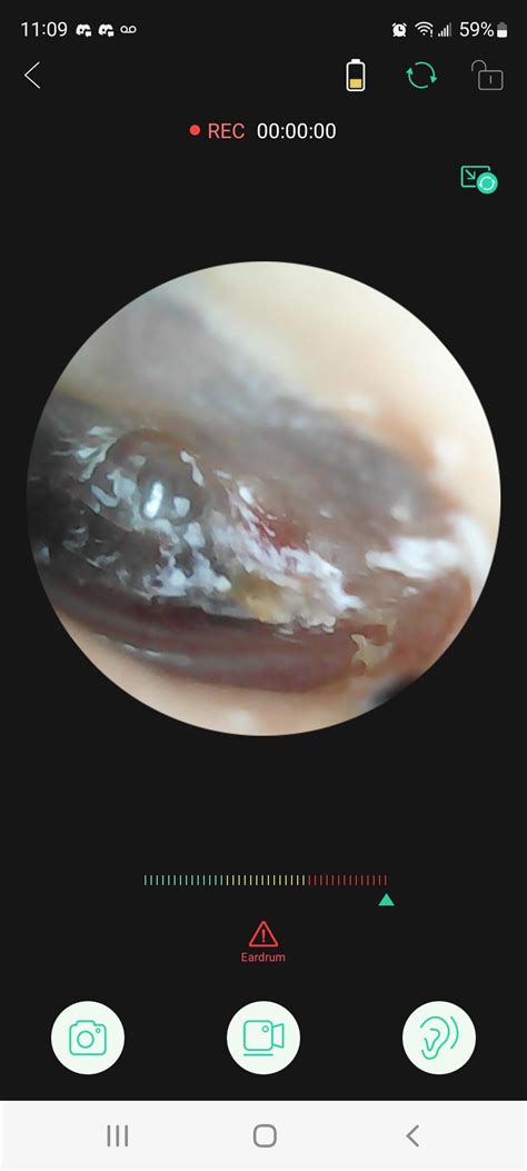What is happening to my ear : r/earwax