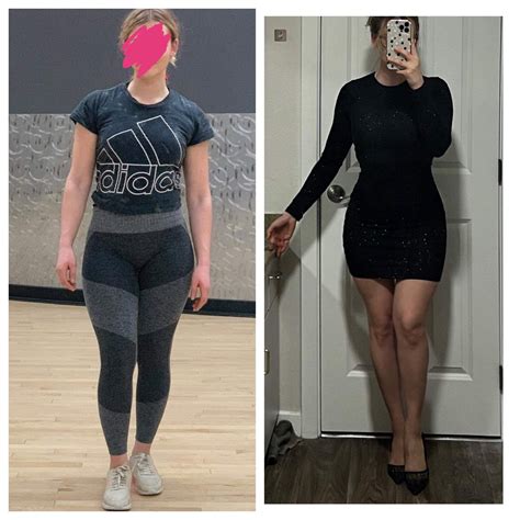 F/28/5'8 [270 lbs-213 lbs= 57lbs] (11 months) Face profile progress ...