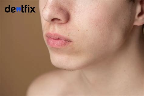 Popping Abscess Tooth 的图像结果