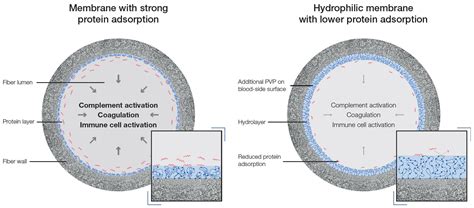 Hydrophilic Modification of Dialysis Membranes | Encyclopedia MDPI