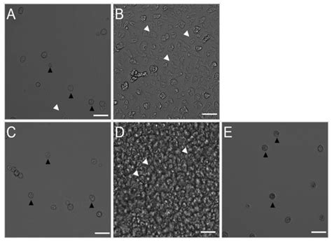 Evaluation of Amebicidal and Cysticidal Activities of Antifungal Drug ...