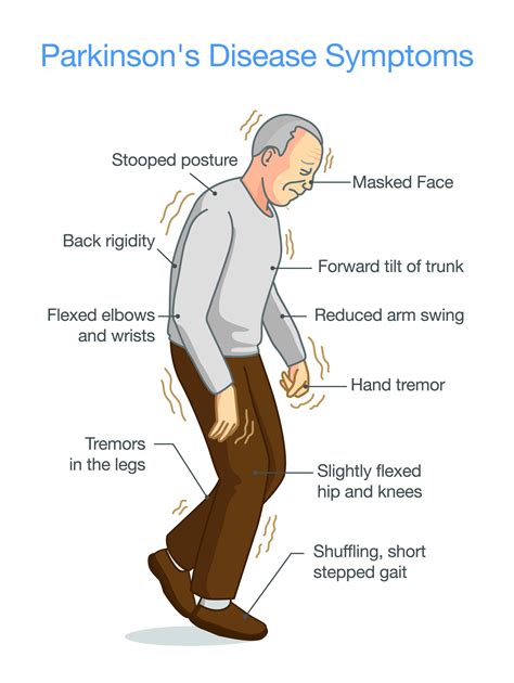 What is Parkinson's Disease?