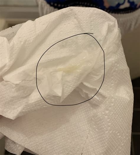 What Does Mucus Plug Look Like In Toilet at Rosie Halsey blog