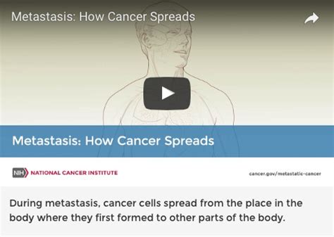 How Cancer Cells Spread in the Body | NIH News in Health