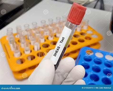 Test Tube with Blood Sample for DHEAS Dehydroepiandrosterone Sulfate Hormone Test. Stock Photo ...