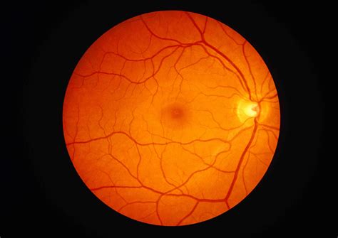 The Anatomy of the Retina