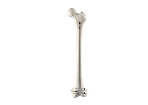 Image result for Alien Spider iOS