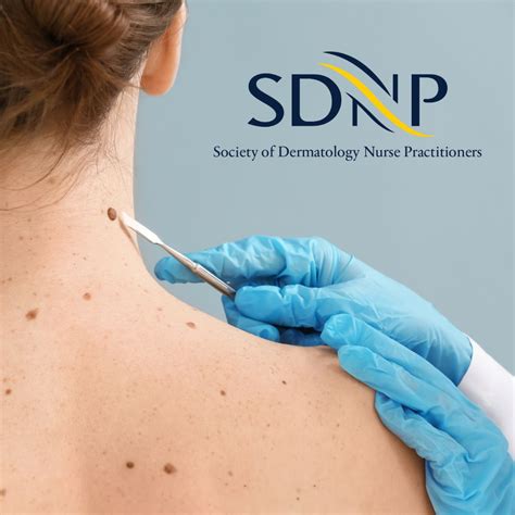 Dermatology Nurse Practitioner