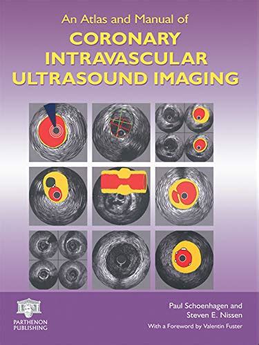 An Atlas and Manual of Coronary Intravascular Ultrasound Imaging eBook ...