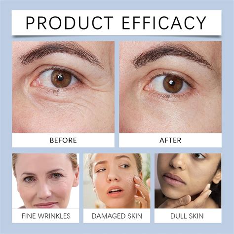 MUBSEOTH Olavita Serum Facial Serum, Vitamin C & E Serum, India | Ubuy