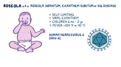 Video: Roseola (Exanthem subitum): Nursing | Osmosis