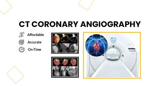 CT Coronary Angiography Test Price In Delhi - Save Upto 30%