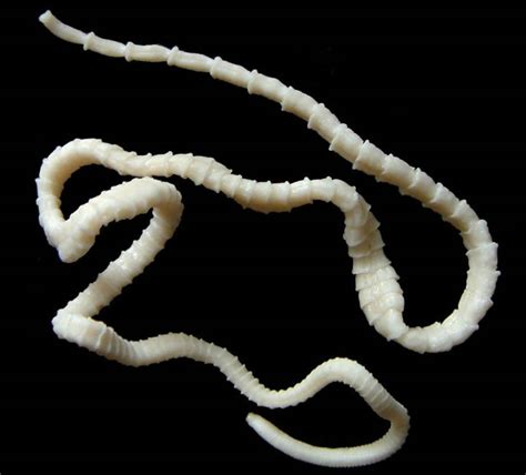 Taenia Solium Pork Tapeworm Microbiologynotes