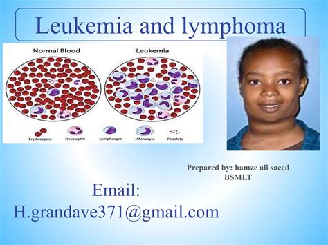 leukemia and lymphoma | PPTX