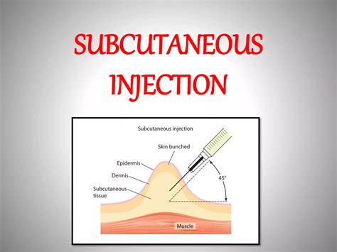 Intradermal vs Subcutaneous Injection 的图像结果