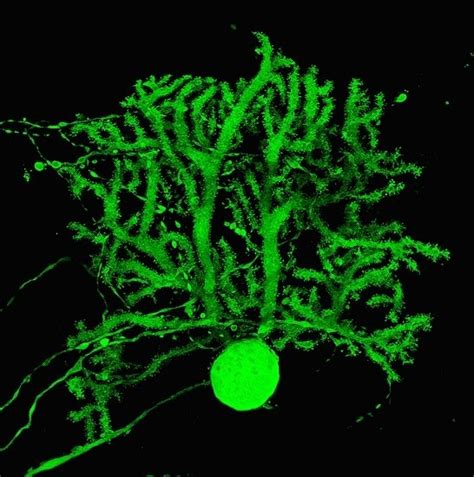 Cerebellar Expression of the Neurotrophin Receptor p75 in Naked-Ataxia ...