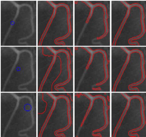 Image result for Normal Blood Segmenter Values