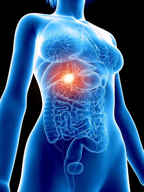 Síntomas de las piedras en la vesícula