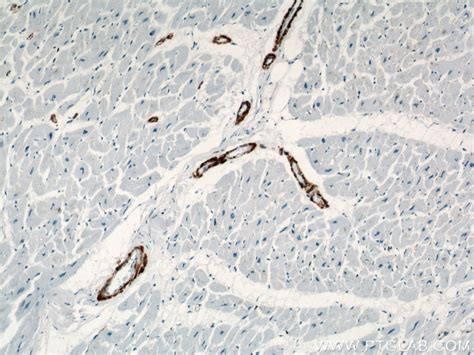 Alpha smooth muscle actin antibody (14395-1-AP) | Proteintech
