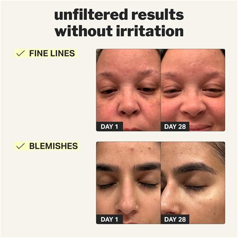 Cocokind Beginner Retinol Gel 0.1%, Improve the India | Ubuy